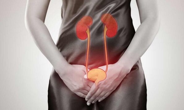 A cystitis oka és kezelése a nőkben