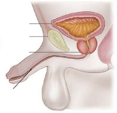 Cystitis férfiakban