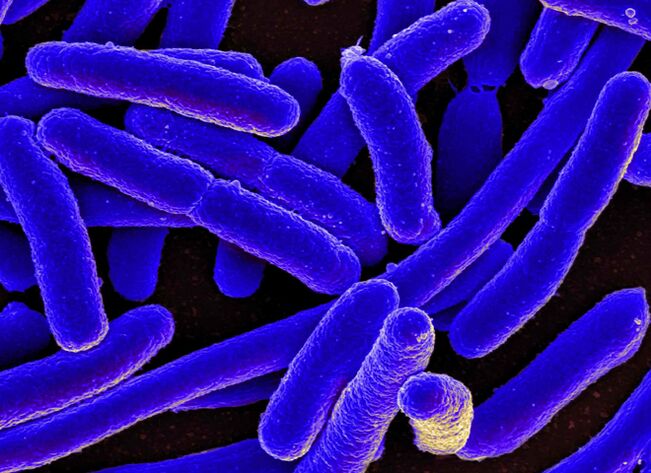 Az E. coli leggyakrabban a cystitis kialakulását provokálja a nőknél